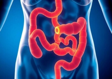 Appendicitis and Bowel Obstruction: Understanding Causes, Symptoms, and Treatments