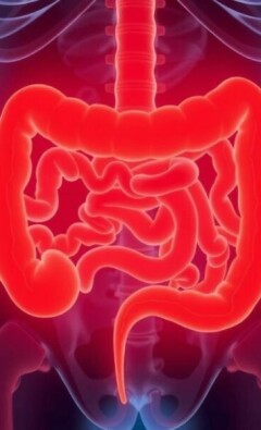 Can Appendicitis Go Away on Its Own? Understanding the Truth About This Common Condition