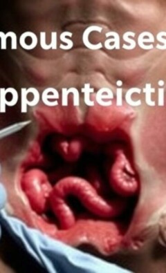 Famous Cases of Appendicitis: Stories That Shaped Medical History