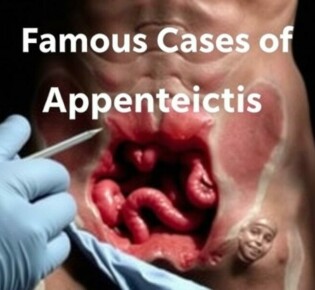 Famous Cases of Appendicitis: Stories That Shaped Medical History