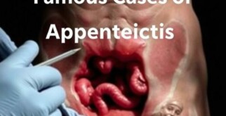 Famous Cases of Appendicitis: Stories That Shaped Medical History