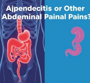 Appendicite ou Autres Douleurs Abdominales : Comment Différencier ?