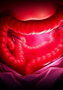 Understanding the Critical Connection Between Appendicitis and Sepsis