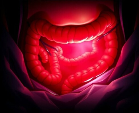 Understanding the Critical Connection Between Appendicitis and Sepsis