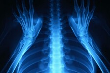 Рентген без страха: понятный и живой гид по лучам, снимкам и безопасности