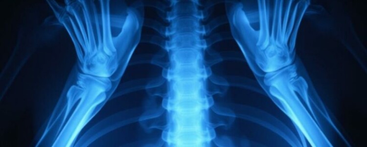 Рентген без страха: понятный и живой гид по лучам, снимкам и безопасности