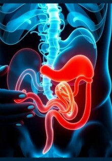 Can Stress Cause Appendicitis? Unraveling the Connection Between Mind and Body