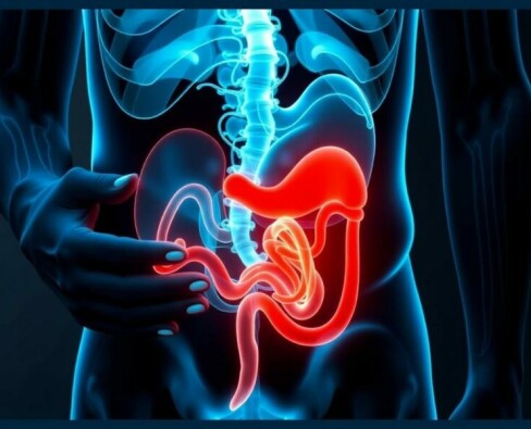 Can Stress Cause Appendicitis? Unraveling the Connection Between Mind and Body