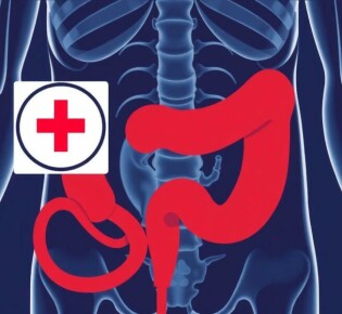 Rovsing-Zeichen: Der wichtige Arzt-Test zur Diagnose der Appendizitis
