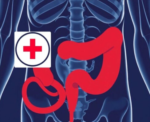 Rovsing-Zeichen: Der wichtige Arzt-Test zur Diagnose der Appendizitis