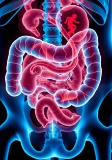 Apendicitis perforada: una emergencia médica que no espera