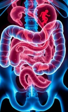 Apendicitis perforada: una emergencia médica que no espera
