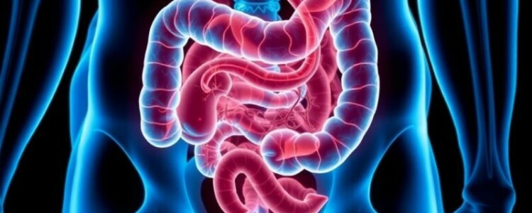 Apendicitis perforada: una emergencia médica que no espera