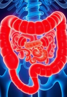 Tumoren des Wurmfortsatzes: Sehr selten, aber möglich – Ein tiefgehender Einblick in eine ungewöhnliche Diagnose