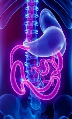 Appendicite et Stress : Existe-t-il un Lien ?