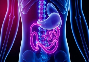 Appendicite et Stress : Existe-t-il un Lien ?