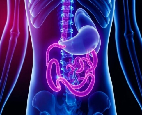 Appendicite et Stress : Existe-t-il un Lien ?