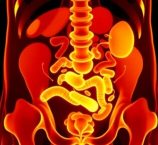 Appendizitis bei älteren Menschen: cursos atípicos que desafían la tradición