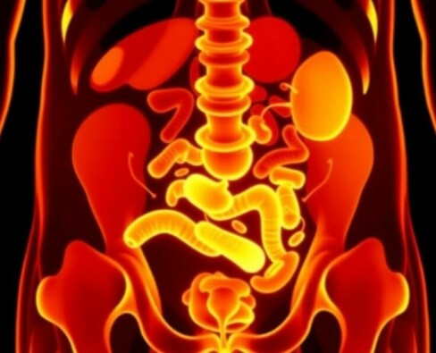 Appendizitis bei älteren Menschen: cursos atípicos que desafían la tradición