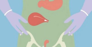 Appendicite Gangréneuse : Dangers et Traitements