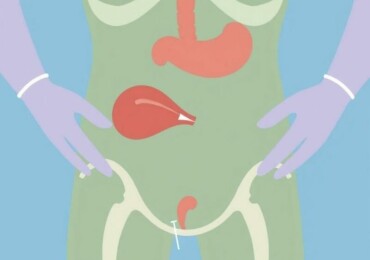 Appendicite Gangréneuse : Dangers et Traitements