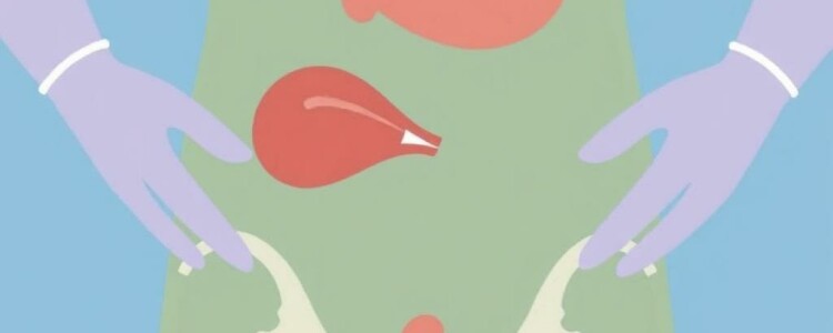 Appendicite Gangréneuse : Dangers et Traitements
