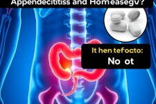 Appendicite et Homéopathie : Efficace ou Non ?