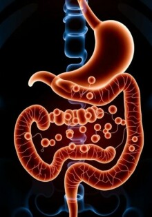 Antibiotic Therapy Alone for Uncomplicated Appendicitis: ¿Una opción viable?