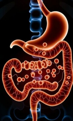 Antibiotic Therapy Alone for Uncomplicated Appendicitis: ¿Una opción viable?