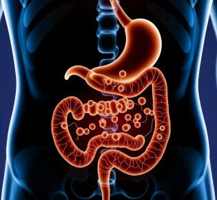 Antibiotic Therapy Alone for Uncomplicated Appendicitis: ¿Una opción viable?