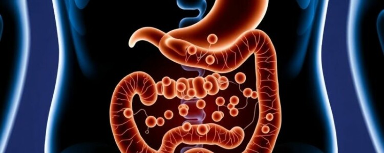 Antibiotic Therapy Alone for Uncomplicated Appendicitis: ¿Una opción viable?