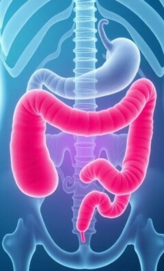 Appendicite et Génétique : Y a-t-il une Prédisposition ?