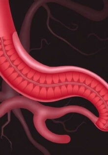El apéndice vermiforme: ¿dónde está y por qué importa conocer su ubicación?