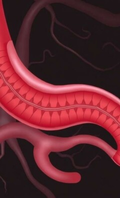 El apéndice vermiforme: ¿dónde está y por qué importa conocer su ubicación?