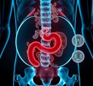Telemedicine for Appendicitis Consultation: A Modern Approach to Emergency Care