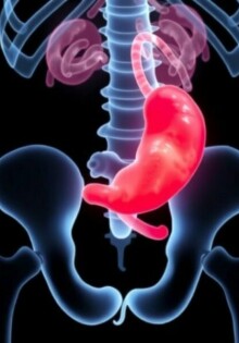 Apendicitis en niños: particularidades en la edad de crecimiento (Appendizitis bei Kindern: Besonderheiten im Wachstumsalter)