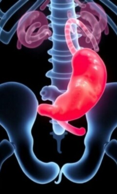Apendicitis en niños: particularidades en la edad de crecimiento (Appendizitis bei Kindern: Besonderheiten im Wachstumsalter)
