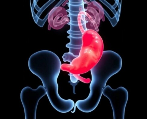 Apendicitis en niños: particularidades en la edad de crecimiento (Appendizitis bei Kindern: Besonderheiten im Wachstumsalter)