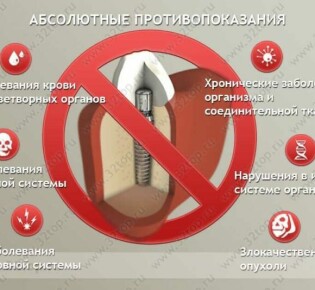 Закупорка желчных протоков: что делать и как избежать осложнений