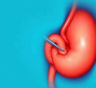 Die Appendizitis als Fallbeispiel in der mündlichen Prüfung: cómo convertir un caso común en una presentación memorable