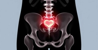 Understanding the Psoas Sign in Appendicitis: A Vital Diagnostic Clue