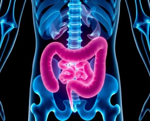 Apendicitis en niños en edad escolar: cómo reconocerla, entenderla y actuar a tiempo