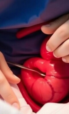 Después de la apendicectomía: qué esperar a largo plazo y cómo cuidar tu cuerpo