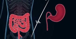 Appendicitis vs. Gastroenteritis: Understanding the Differences and Symptoms