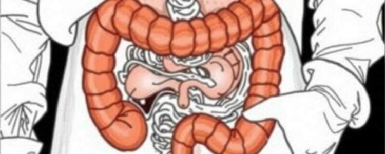 La mortalidad ligada a la apendicitis antes de la era de los antibióticos: cómo una pequeña víscera cambió vidas y medicina