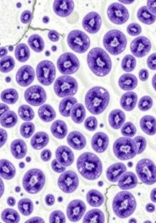 L’hyperplasie lymphoïde de la paroi: entender un fenómeno invisible pero significativo