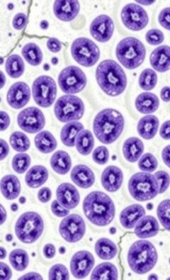 L’hyperplasie lymphoïde de la paroi: entender un fenómeno invisible pero significativo