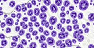 L’hyperplasie lymphoïde de la paroi: entender un fenómeno invisible pero significativo