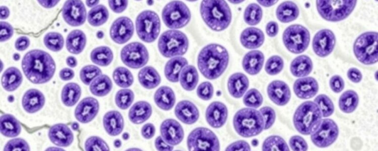 L’hyperplasie lymphoïde de la paroi: entender un fenómeno invisible pero significativo