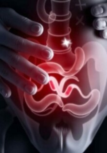 Atypical Appendicitis Symptoms: What You Need to Know Beyond the Classic Signs